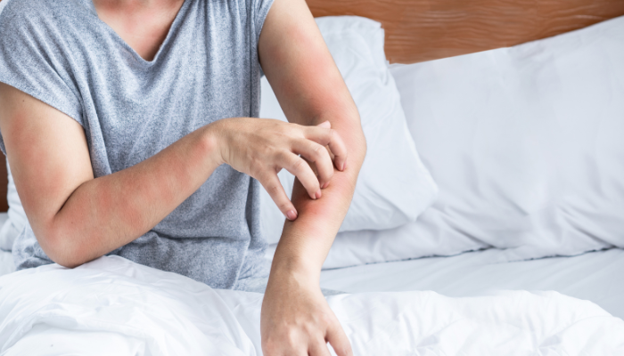 Ακάρεα: Πώς η Καθαριότητα Επηρεάζει την Υγεία μας